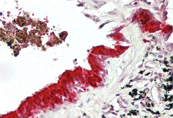 MXI1 Rabbit Polyclonal Antibody