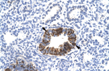 MXI1 Rabbit Polyclonal Antibody