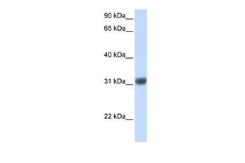 OTX2 Rabbit Polyclonal Antibody
