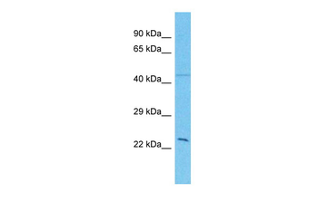 GTF2H3 Rabbit Polyclonal Antibody
