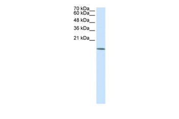 HDAC6 Rabbit Polyclonal Antibody