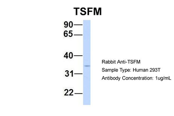 TSFM Rabbit Polyclonal Antibody