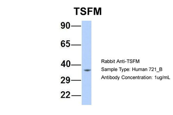 TSFM Rabbit Polyclonal Antibody