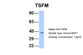 TSFM Rabbit Polyclonal Antibody