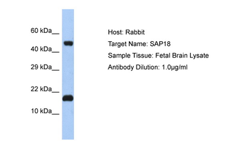 SAP18 Rabbit Polyclonal Antibody
