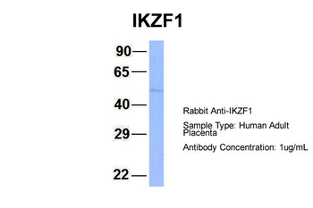 IKZF1 Rabbit Polyclonal Antibody