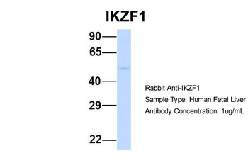 IKZF1 Rabbit Polyclonal Antibody