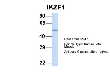 IKZF1 Rabbit Polyclonal Antibody