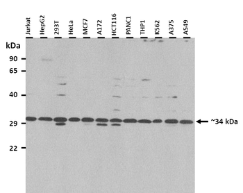 CDX2 Rabbit Polyclonal Antibody