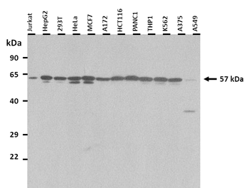 RIPK3 Rabbit Polyclonal Antibody