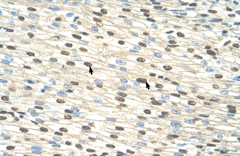 RIPK3 Rabbit Polyclonal Antibody