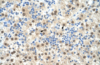 RIPK3 Rabbit Polyclonal Antibody
