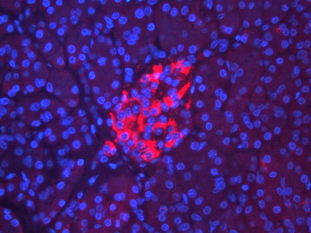 RIPK3 Rabbit Polyclonal Antibody