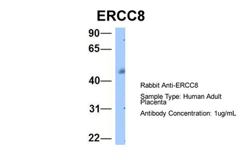 ERCC8 Rabbit Polyclonal Antibody
