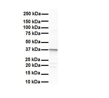 ERCC8 Rabbit Polyclonal Antibody