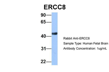 ERCC8 Rabbit Polyclonal Antibody