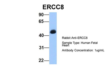ERCC8 Rabbit Polyclonal Antibody