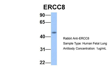 ERCC8 Rabbit Polyclonal Antibody