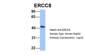 ERCC8 Rabbit Polyclonal Antibody