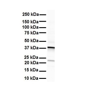 ERCC8 Rabbit Polyclonal Antibody