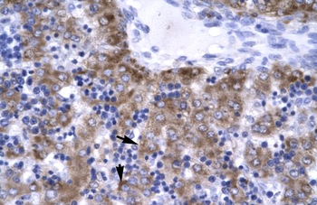 ERCC8 Rabbit Polyclonal Antibody