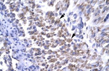 ERCC8 Rabbit Polyclonal Antibody