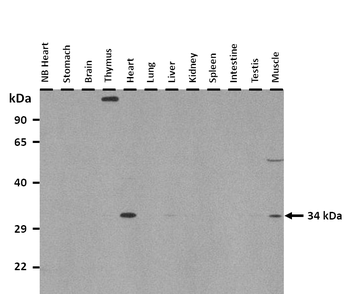DBP Rabbit Polyclonal Antibody