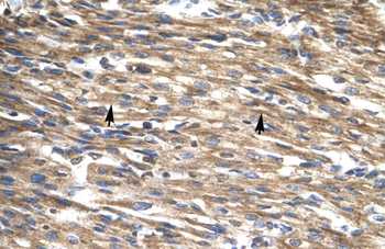 DBP Rabbit Polyclonal Antibody