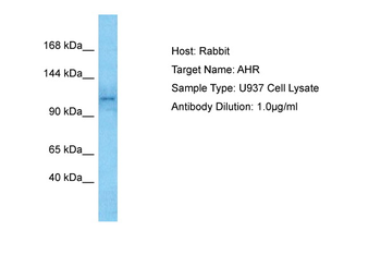 AHR Rabbit Polyclonal Antibody