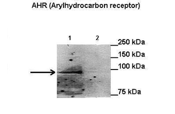 AHR Rabbit Polyclonal Antibody