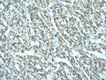 FGD1 Rabbit Polyclonal Antibody