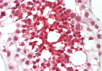 FGD1 Rabbit Polyclonal Antibody