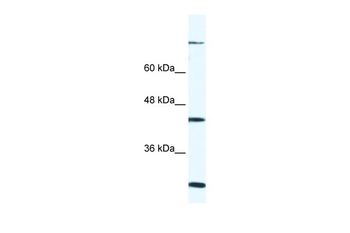 FGD1 Rabbit Polyclonal Antibody