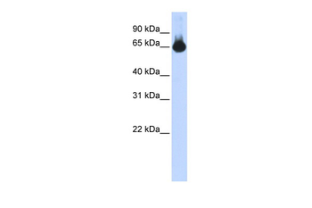 FOXG1 Rabbit Polyclonal Antibody