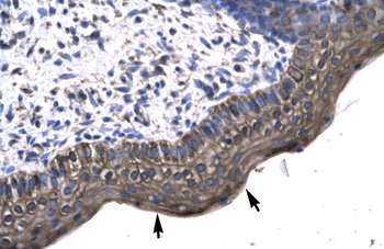 KIN Rabbit Polyclonal Antibody