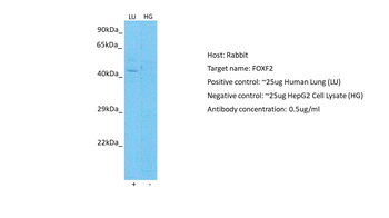 FOXF2 Rabbit Polyclonal Antibody