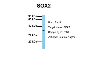 SOX2 Rabbit Polyclonal Antibody