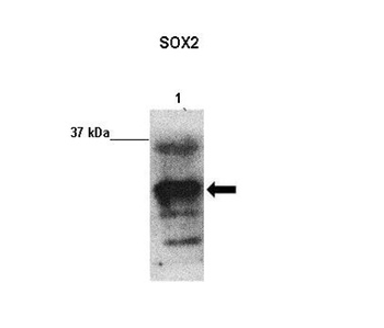 SOX2 Rabbit Polyclonal Antibody