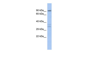 SOX2 Rabbit Polyclonal Antibody