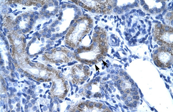 SSBP2 Rabbit Polyclonal Antibody
