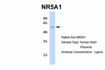 NR5A1 Rabbit Polyclonal Antibody