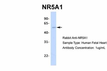 NR5A1 Rabbit Polyclonal Antibody