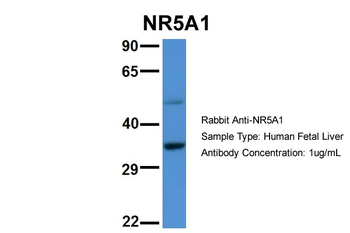 NR5A1 Rabbit Polyclonal Antibody
