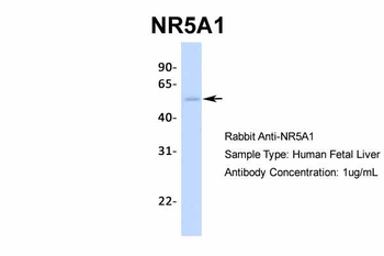 NR5A1 Rabbit Polyclonal Antibody