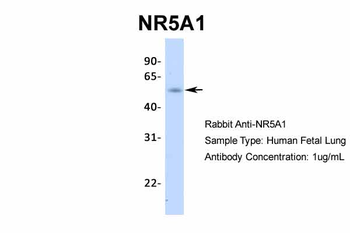 NR5A1 Rabbit Polyclonal Antibody