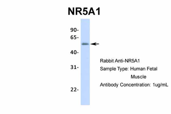 NR5A1 Rabbit Polyclonal Antibody