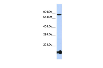 BCL6 Rabbit Polyclonal Antibody