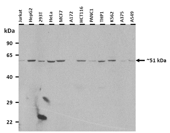 GATA2 Rabbit Polyclonal Antibody