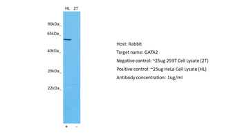 GATA2 Rabbit Polyclonal Antibody