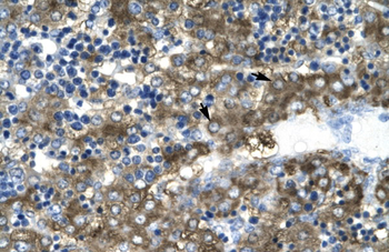 GATA2 Rabbit Polyclonal Antibody